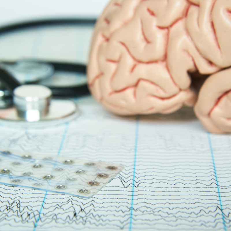 Neurofeedback behandeling BrainNetwork Zeist en Soest
