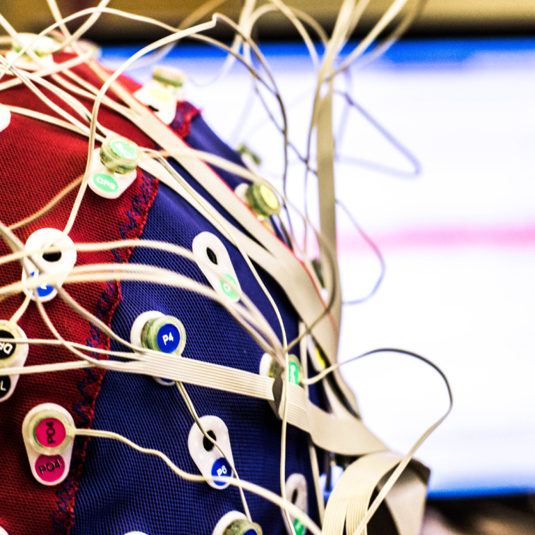 Overprikkeling behandeling neurofeedback BrainNetwork Soest